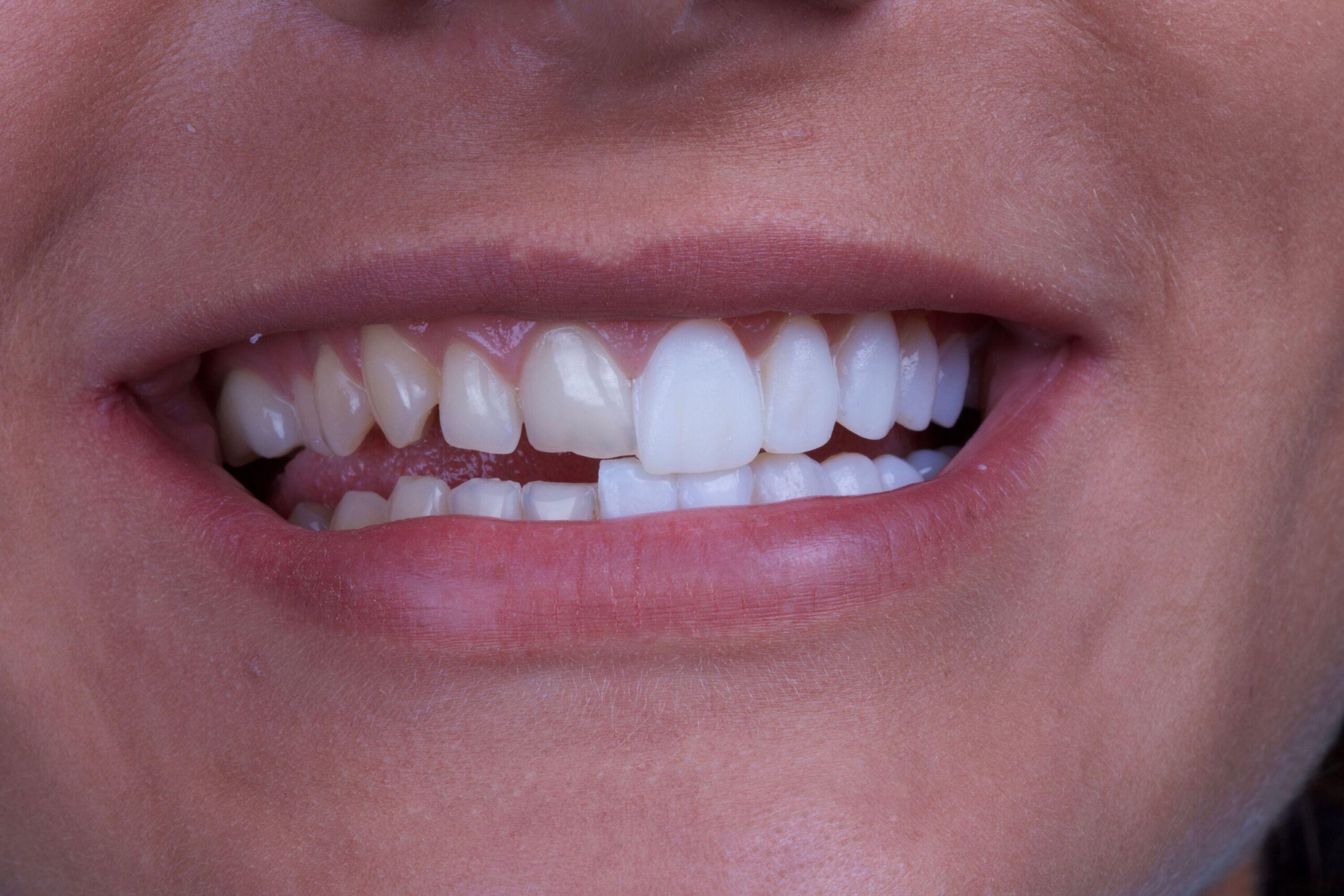 Specialized Dental Clinics for Orthodontic Treatments